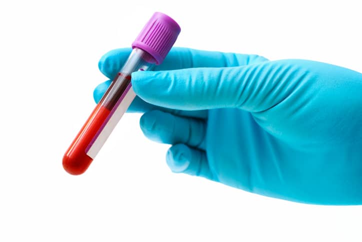 Blue gloved hand holding a blood sample in a vile
